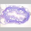 Ureter 02.jpg